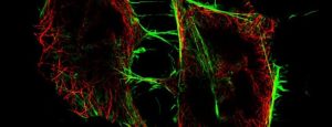 TissueGnostics Confocal
