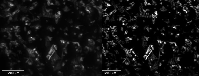 VITVO 3D - Tumor cells