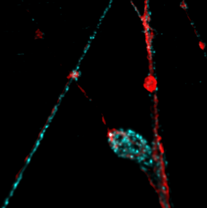 FigureB_RegionOfInterest_SX Axonal regeneration