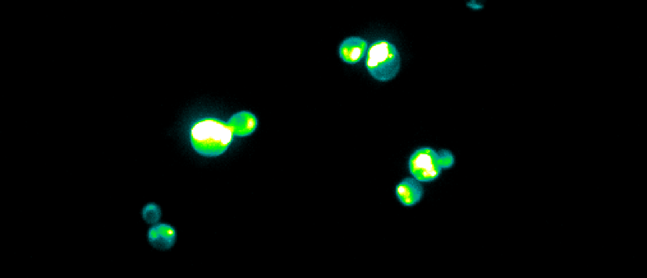 confocal microscopy