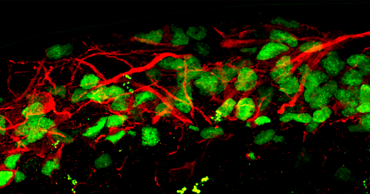 cortical neurons