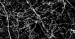 DeepSIM of neurobiological samples