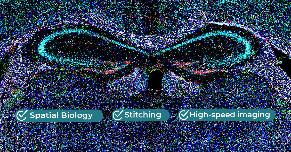 spatial transcriptomics banner