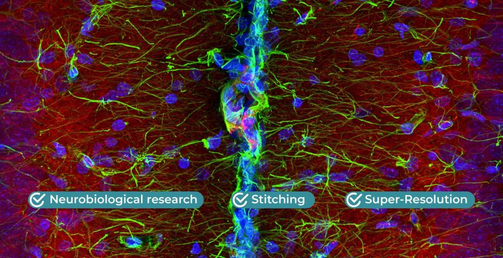从共聚焦成像到超高分辨率成像的无缝进化， 用于神经生物学研究