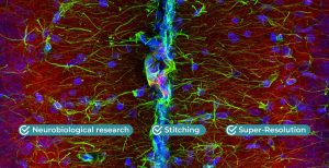 从共聚焦成像到超高分辨率成像的无缝进化， 用于神经生物学研究