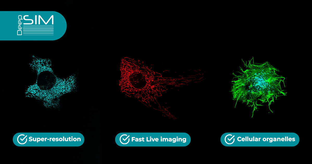 structured illumination microscopy