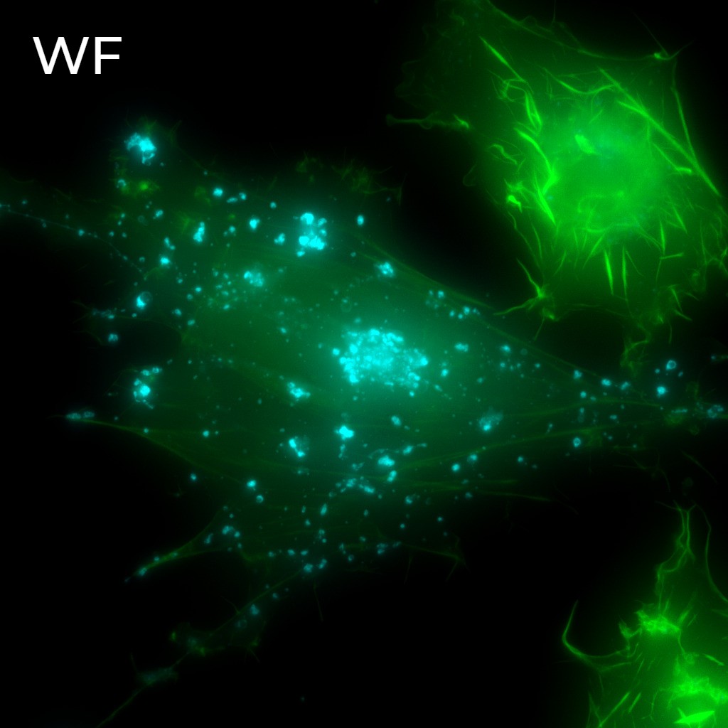 structured illumination microscopy