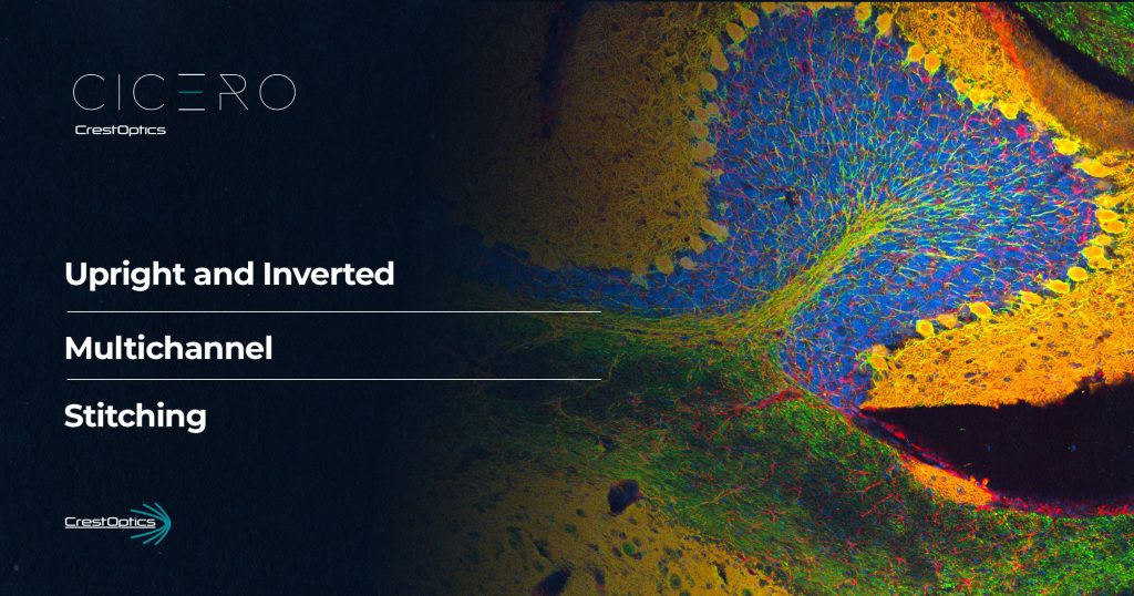 Unlocking the potential of CICERO spinning disk system: exploring diverse applications