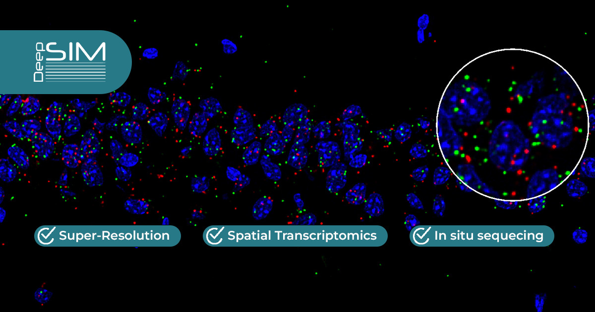 Super-risolution Microscopy