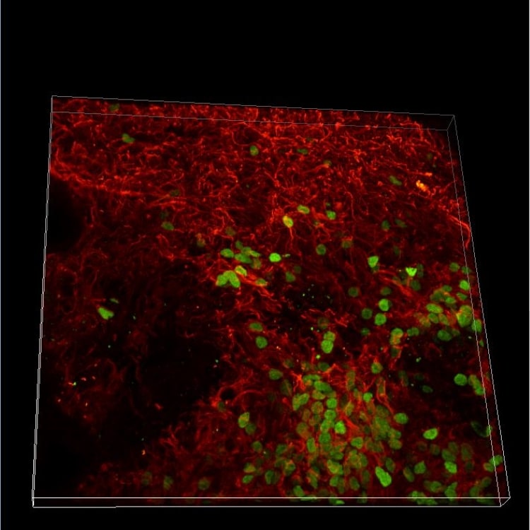 25mm-brain-organoid.jpg