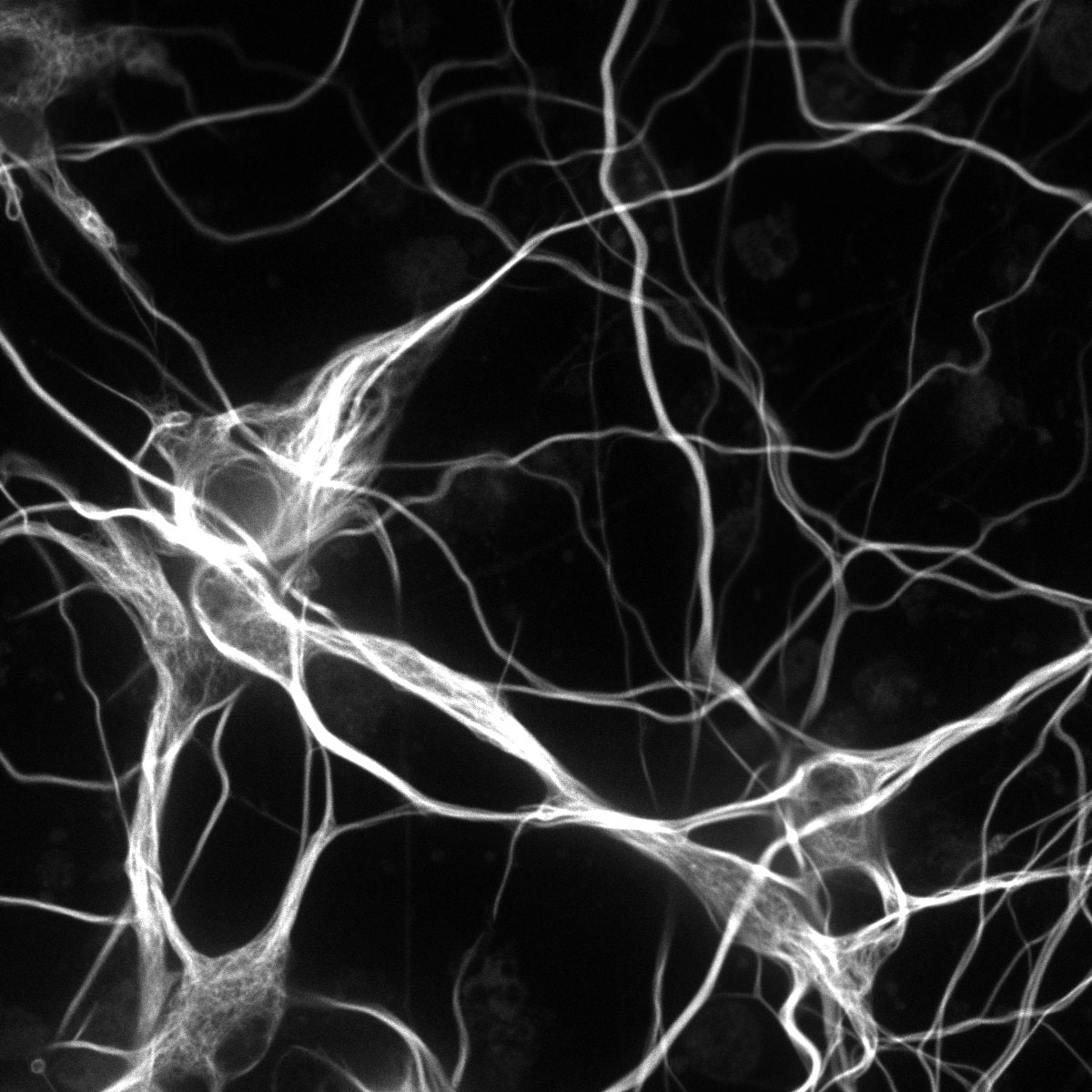 neurons-18mm_RGB.jpg neurons-18mm_RGB.jpg