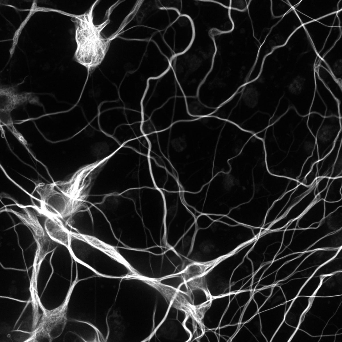 neurons-25mm_RGB.jpg