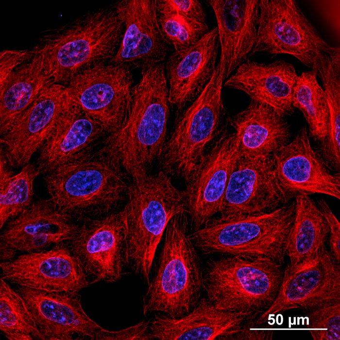 5_sx_U2OS_tubulin_laminin_CICERO_Panda18mm_Celesta-MaxIP_RGB-min.jpg
