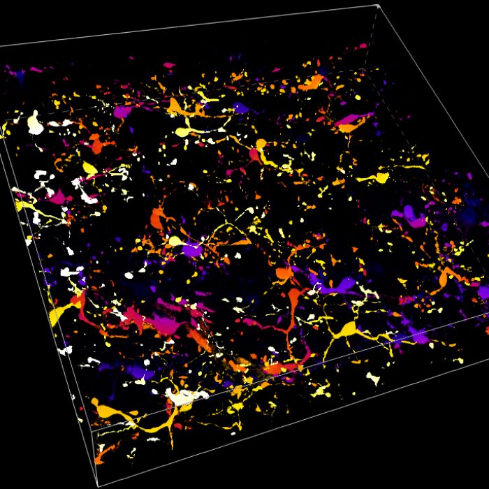 MB_microglia_60x_Cicero_Zstack_Panda18mm_Celesta_snap.jpg