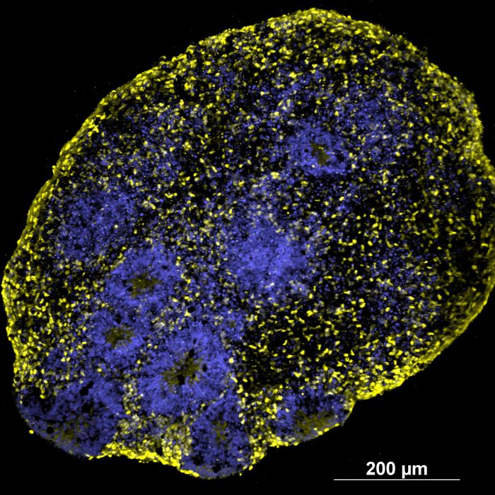 Organoids_20x_Cicero_Fusion-BT_22mm_single-FOV-MaxIP_RGB-min.jpg