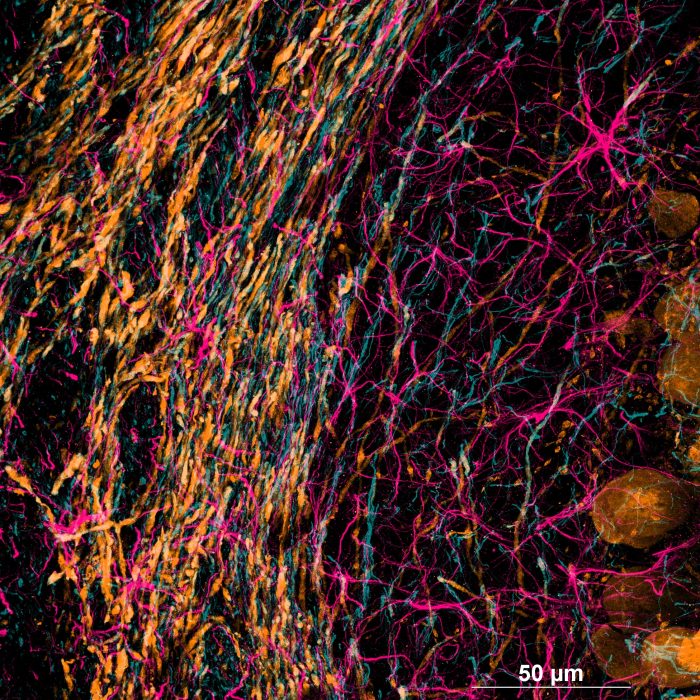 RatBrain_60x_Cicero_Zstack_NF-L_Calbinding_GFAP_AURA_Panda18mm-MaxIP_RGB-min.jpg