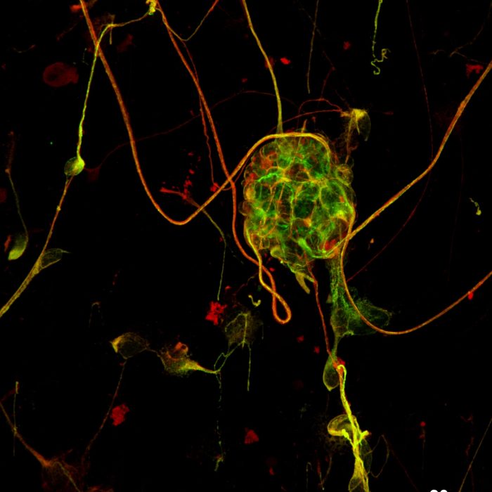 RetinalGanglionCells_60x_CICERO_Panda18mm_AURA-MaxIP_RGB-min.jpg